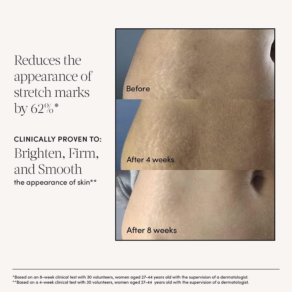 Pregnancy Stretch Mark Cream, Belly Serum & Soothing Mask Set